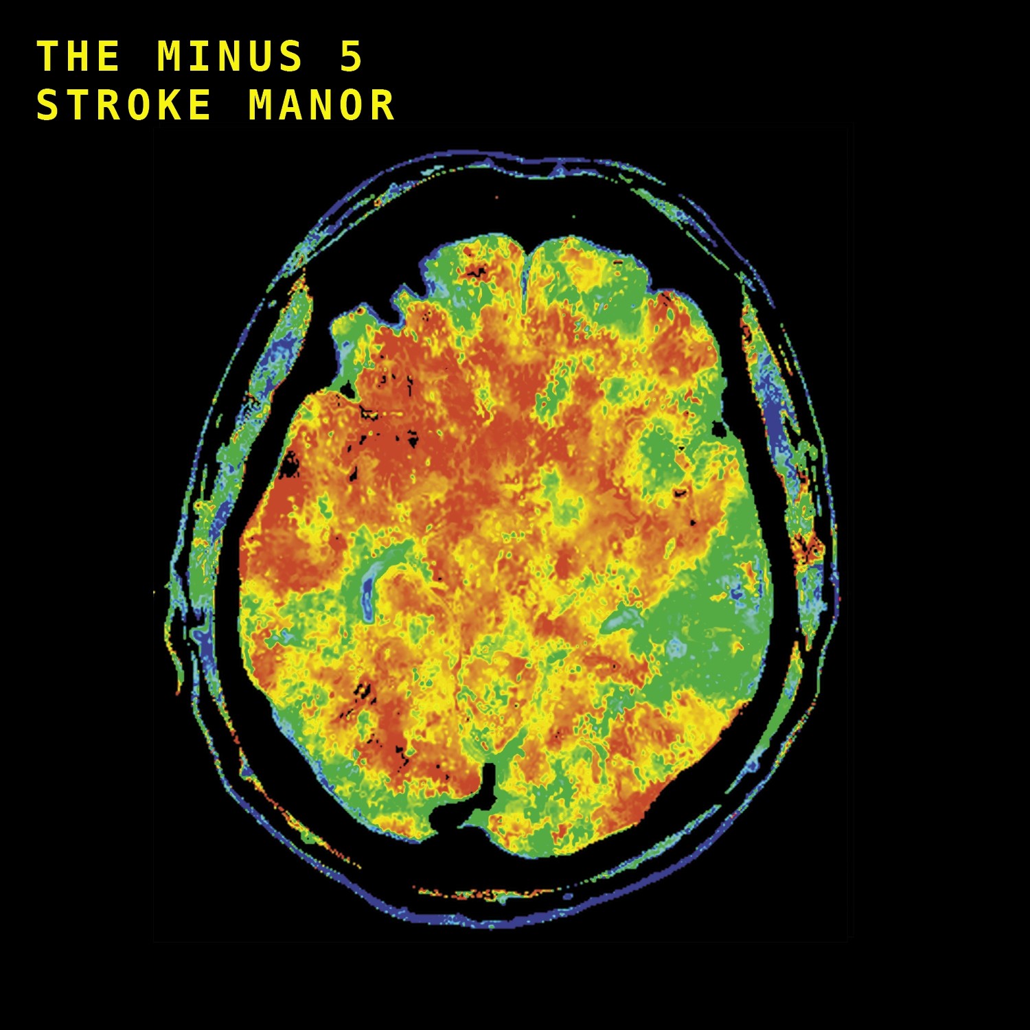 The Minus 5 - Stroke Manor